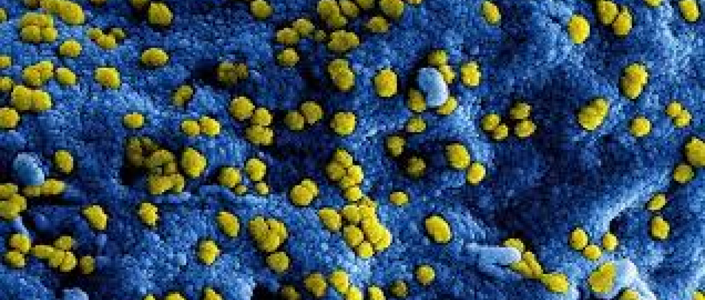 Coronavirus